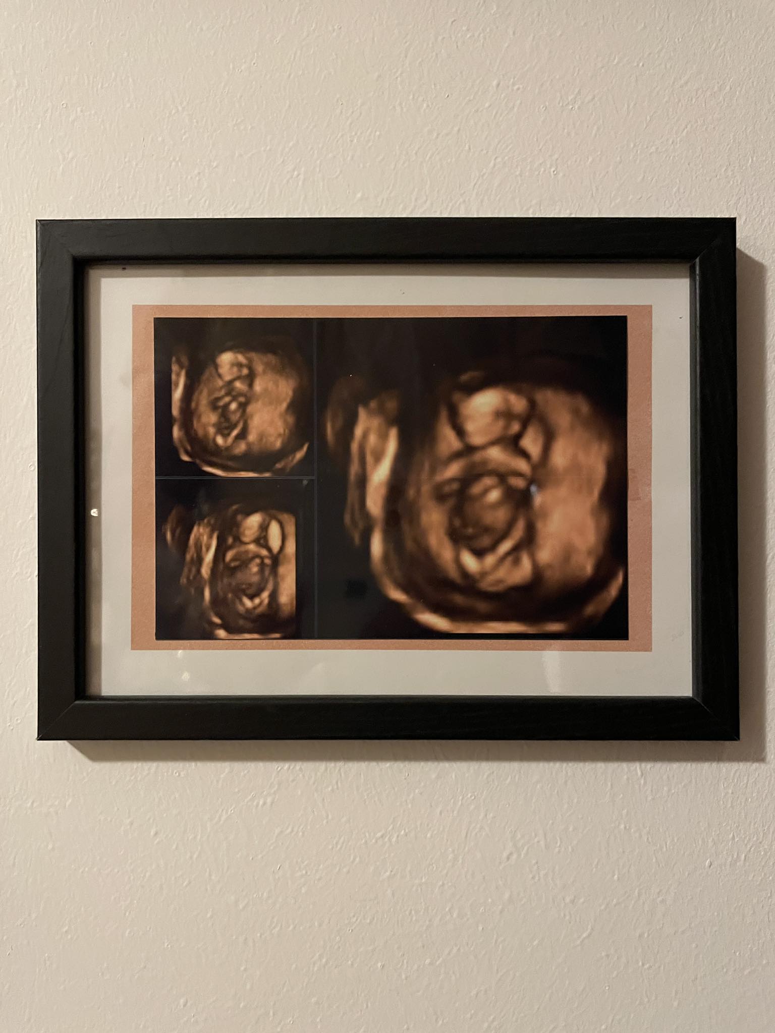 A kihívást jelentő reggeli rosszullétek és ami mögötte van